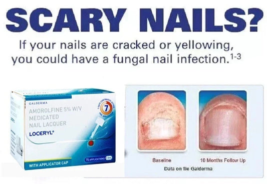 Nail Fun-gal Lacquer 2.5ML FREE & FAST DELIVERY